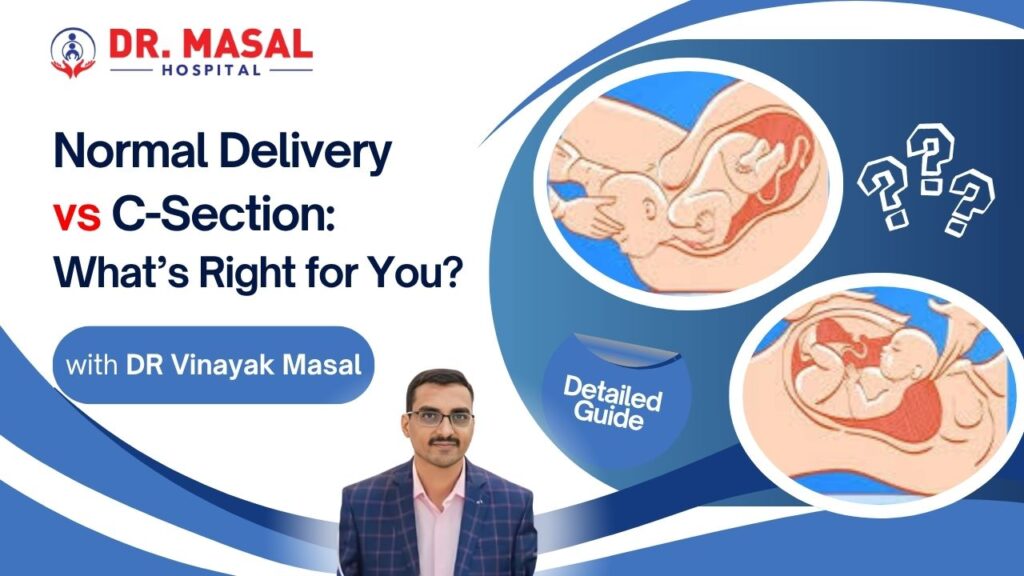 Detailed guide image comparing normal and cesarean deliveries for expectant mothers reading about childbirth options